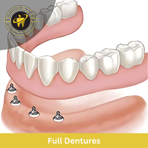 Full Dentures