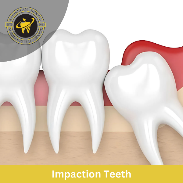 Impaction Teeth