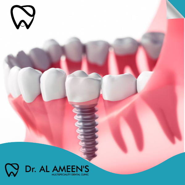Implantology