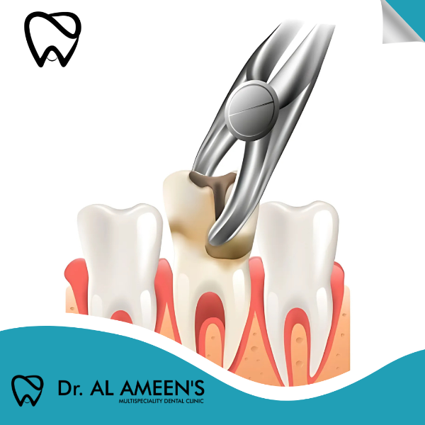 TOOTH EXTRACTION