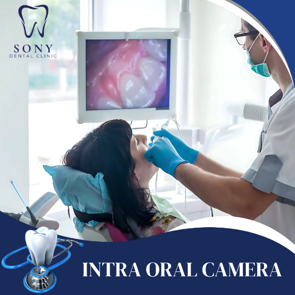 INTRA ORAL CAMERA