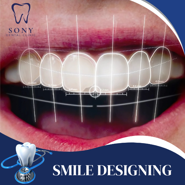 SMILE DESIGNING