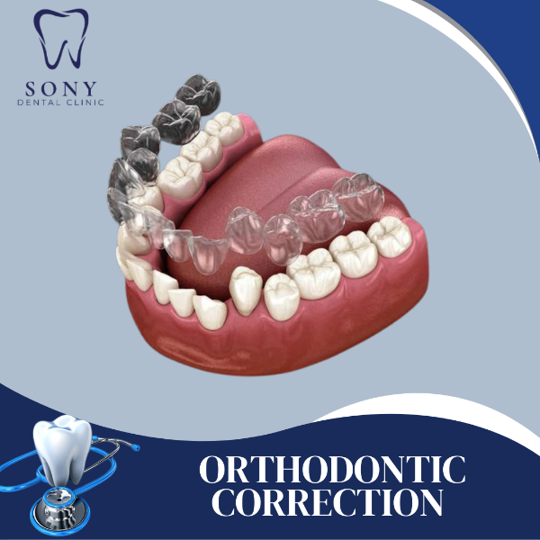 ORTHO DONTIC CORRECTION