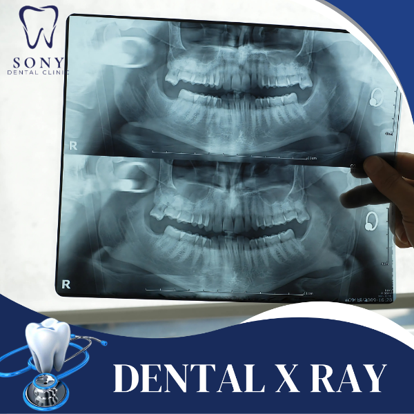 DENTAL X RAY