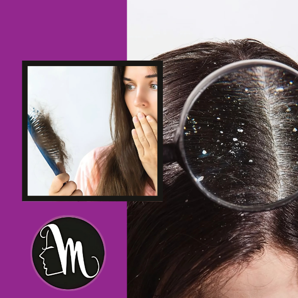 Hair Loss & Dandruff Treatment