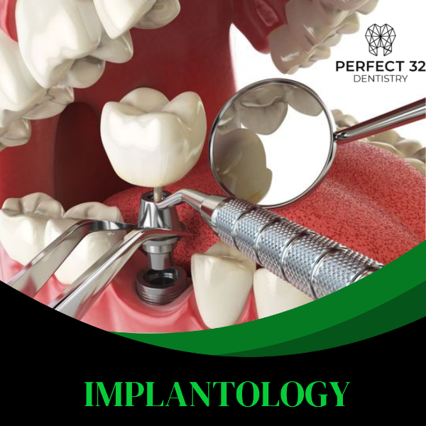 IMPLANTOLOGY