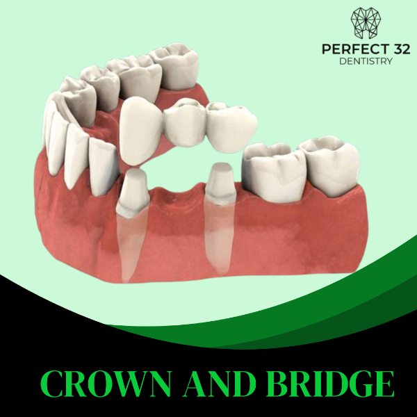 CROWN AND BRIDGE