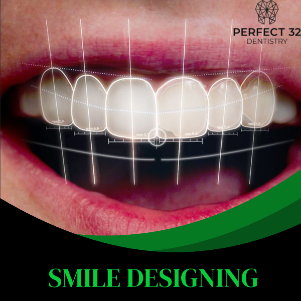 SMILE DESIGNING
