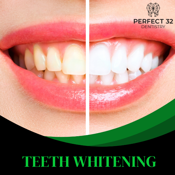 TEETH WHITENING