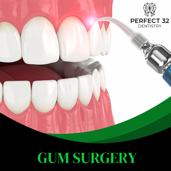 GUM SURGERY