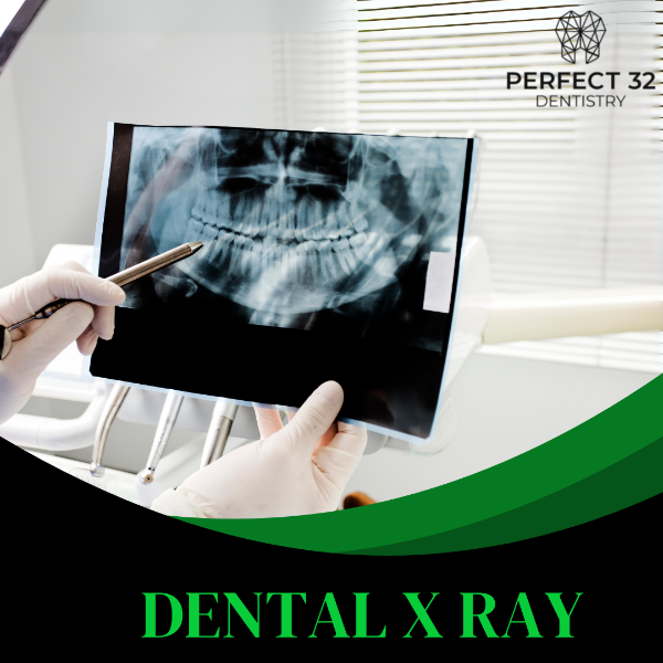 DENTAL X RAY