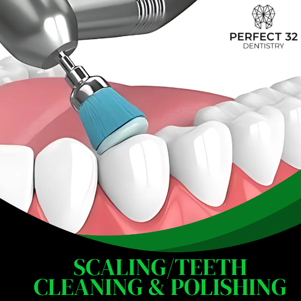 SCALING/TEETH CLEANING & POLISHING