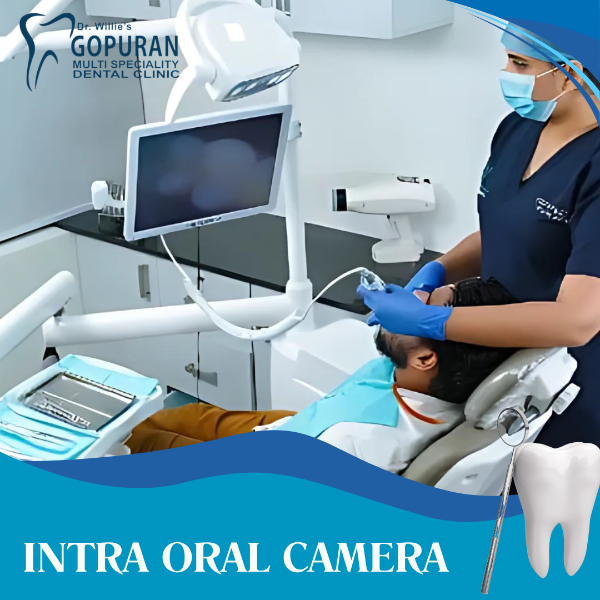 INTRA ORAL CAMERA