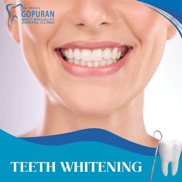 TEETH WHITENING