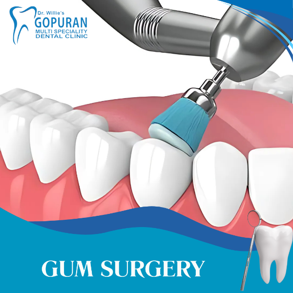 GUM SURGERY