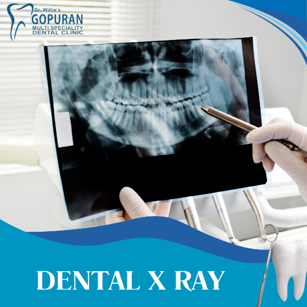 DENTAL X RAY