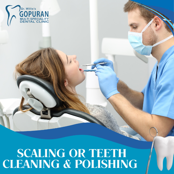 SCALING OR TEETH CLEANING & POLISHING