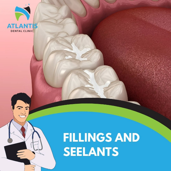 Fillings and Seelants