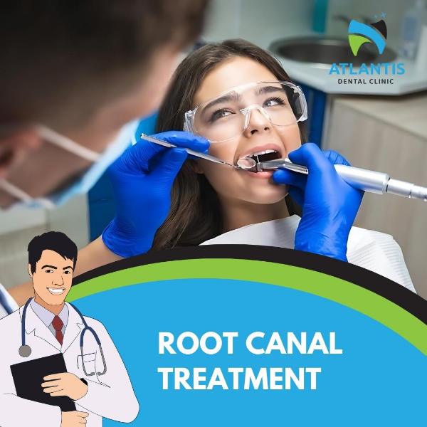 Root Canal treatment