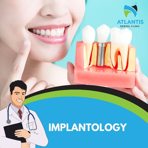 Implantology