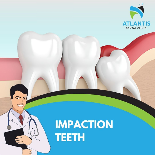 Impaction teeth