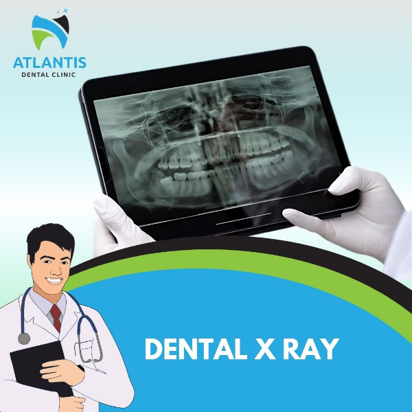 Dental X Ray