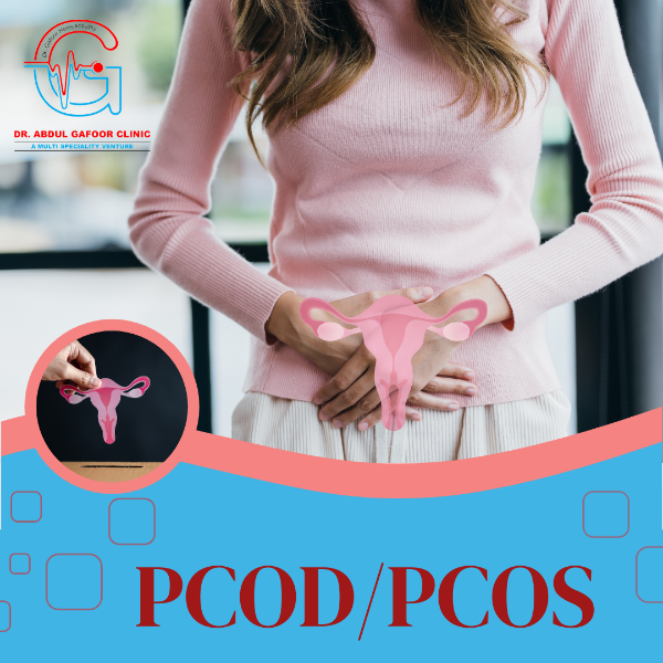 PCOD/PCOS