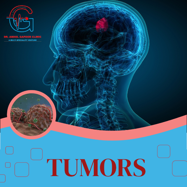 TUMORS