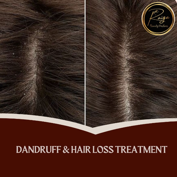 DANDRUFF&HAIR LOSS TREATMENT