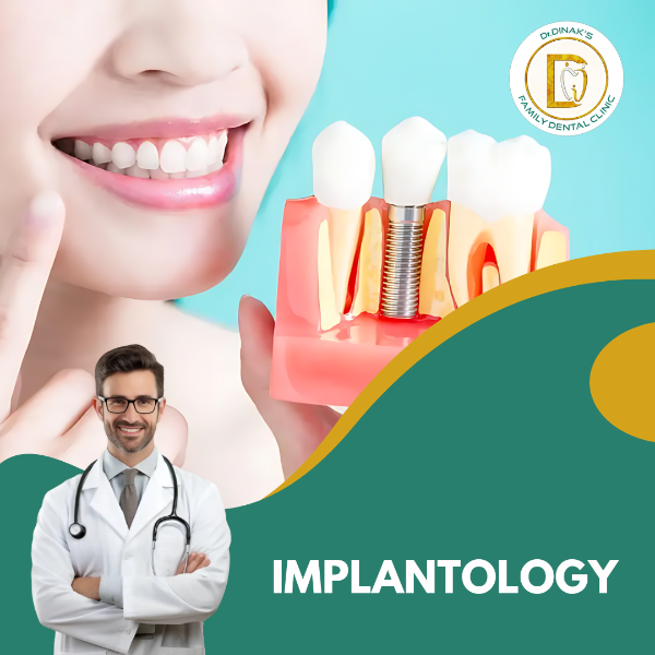 IMPLANTOLOGY