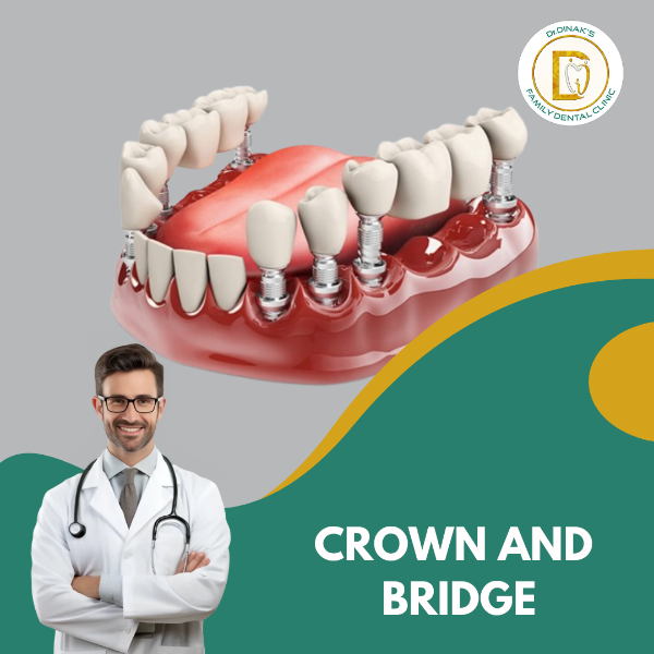 CROWN AND  BRIDGE