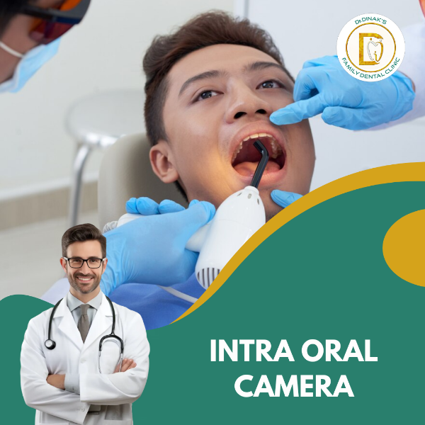 INTRA ORAL CAMERA