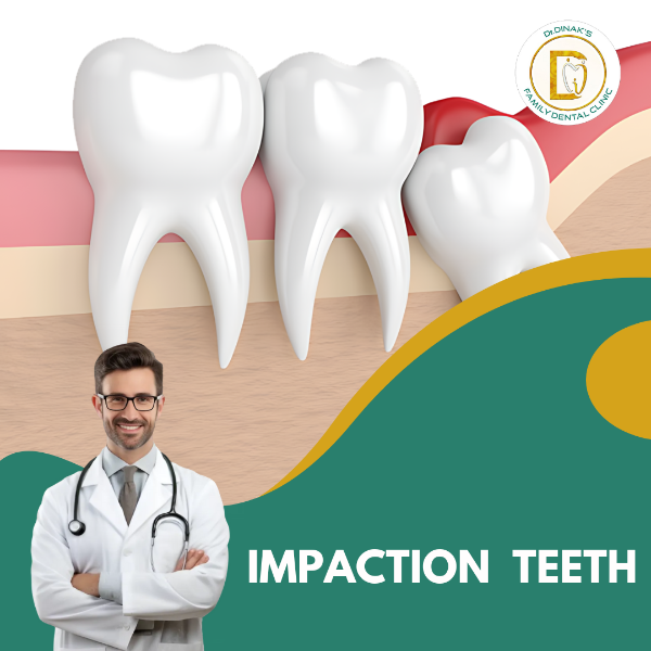 IMPACTION  TEETH