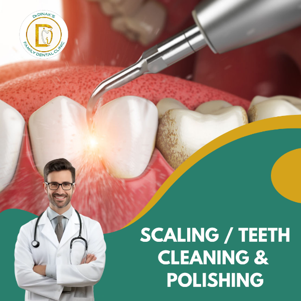 SCALING / TEETH CLEANING &  POLISHING