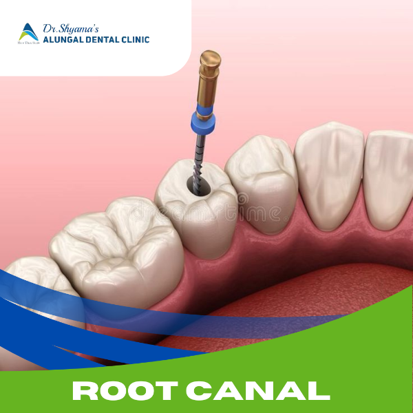ROOT CANAL