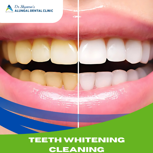 TEETH WHITENING & CLEANING