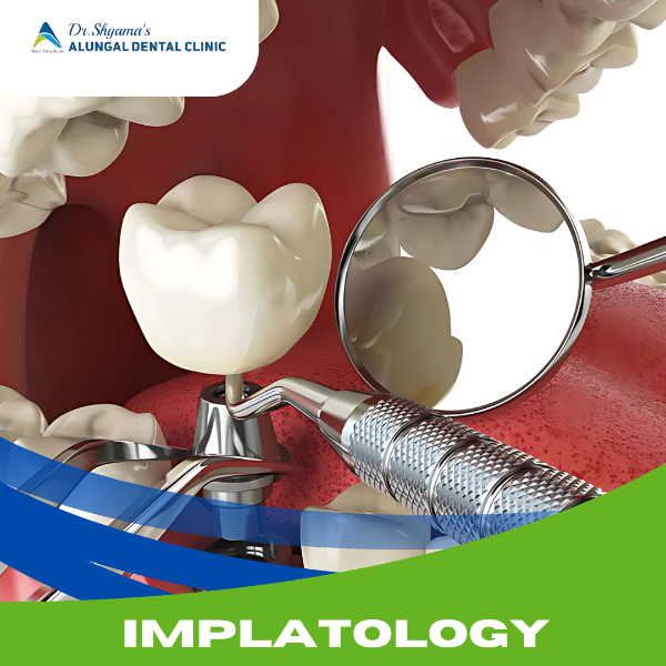 IMPLANTOLOGY