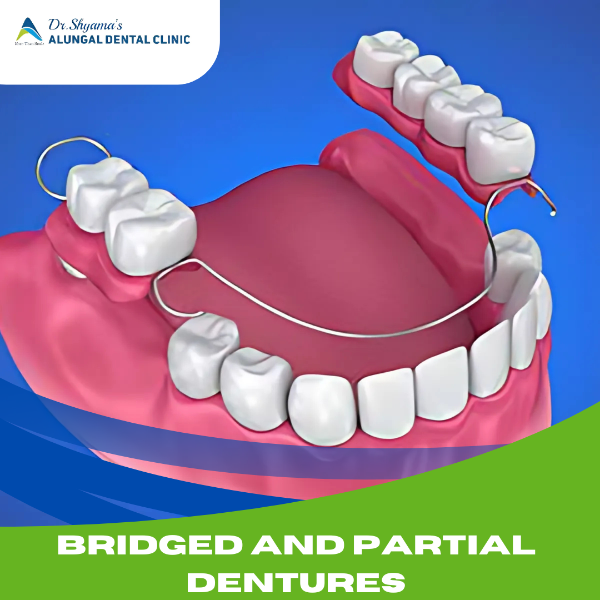 BRIDGES AND PARTIAL DENTURES
