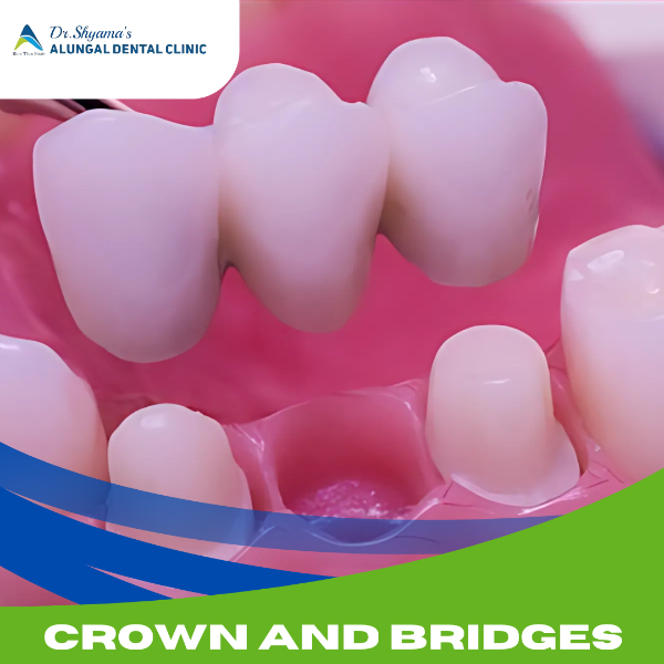 CROWN AND BRIDGE