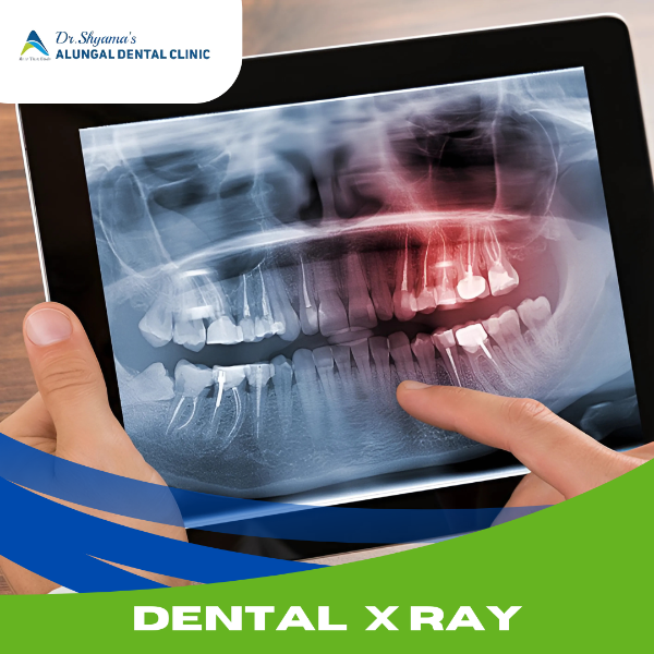 DENTAL X RAY