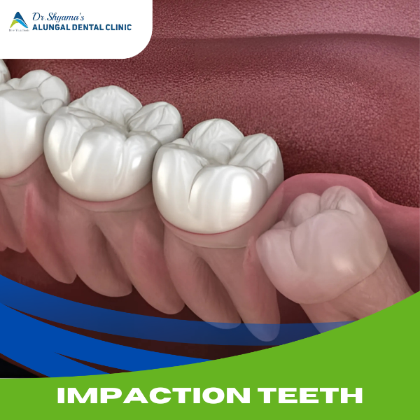 IMPACTION TEETH