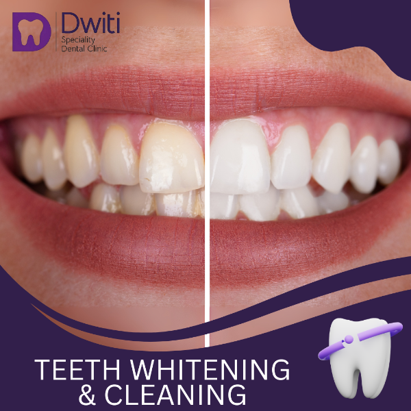 TEETH WHITENING & CLEANING