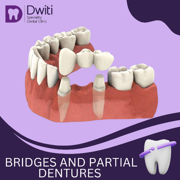 BRIDGES & PARTIAL DENTURES