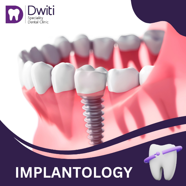 IMPLANTOLOGY