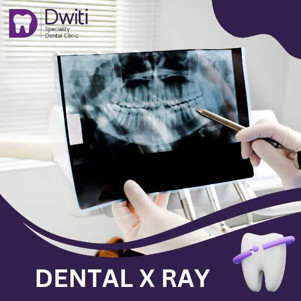 DENTAL X RAY