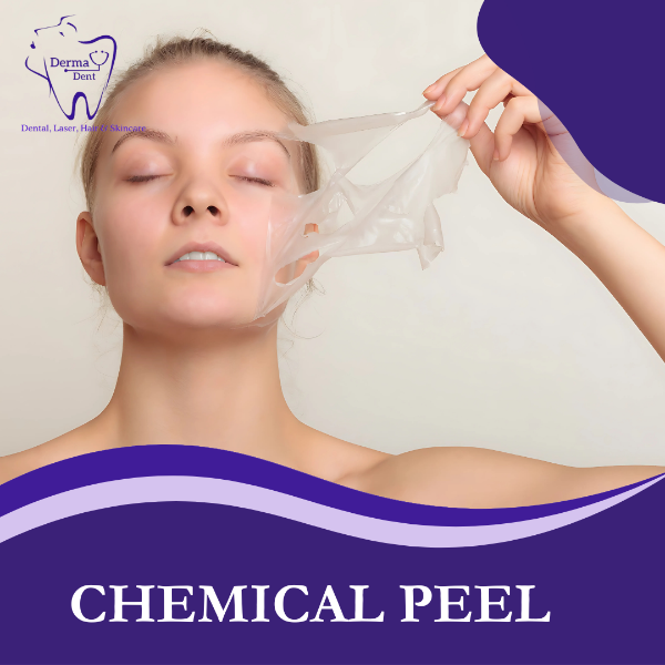 CHEMICAL PEEL