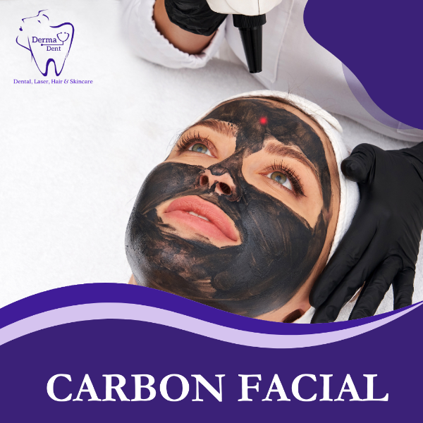 CARBON FACIAL