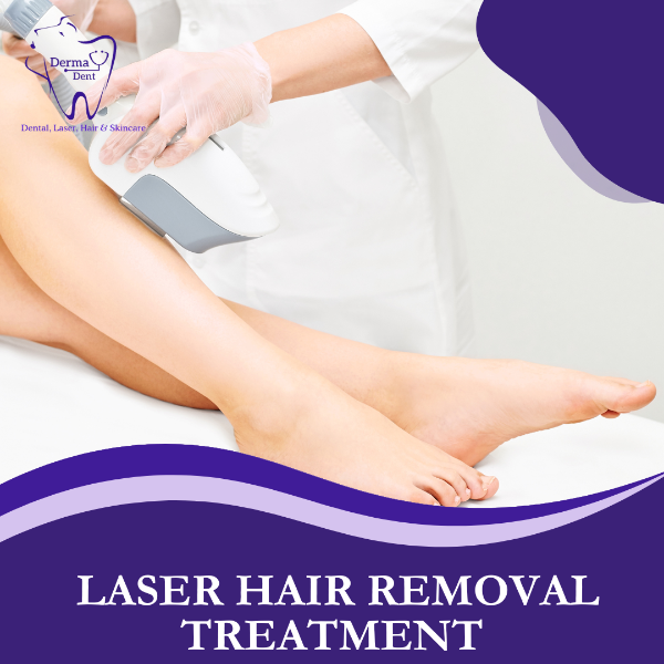 LASER HAIR REMOVAL TREATMENT