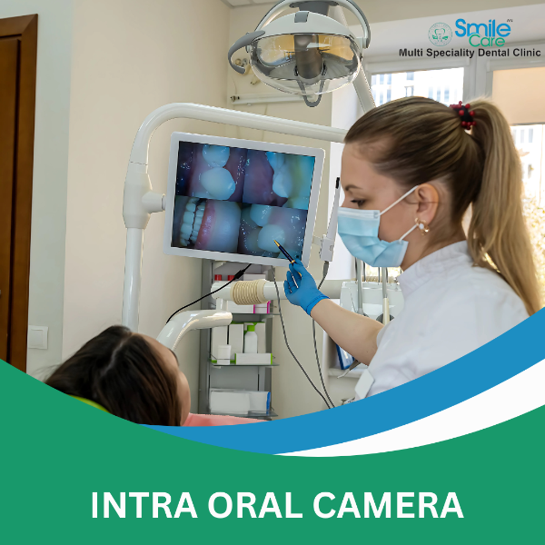 INTRA ORAL CAMERA