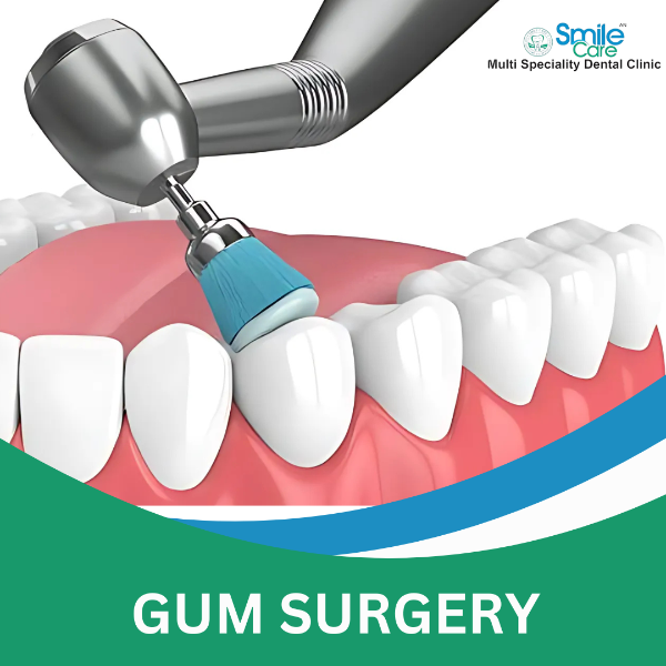 GUM SURGERY